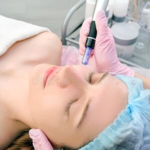 DERMAPEN Y MESOROLLER