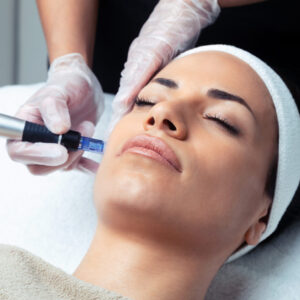 MICRONEEDLING